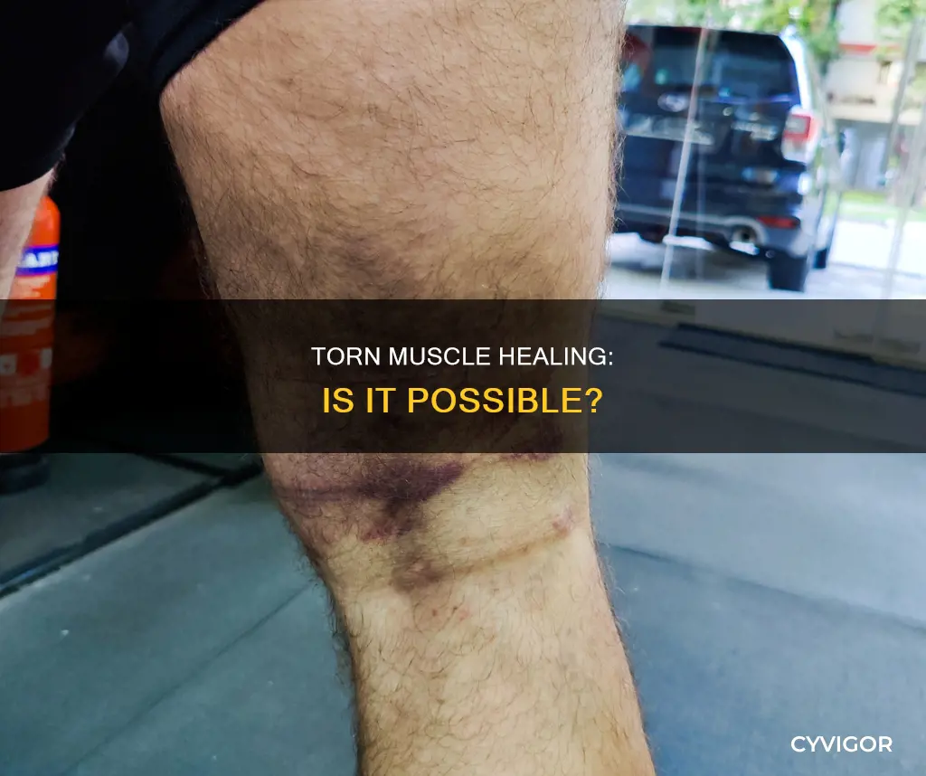 will a torn muscle heal