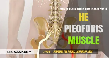 Pinched Sciatic Nerve: Can It Cause Piriformis Muscle Pain?
