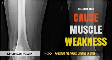 Bow Legs and Muscle Weakness: Understanding the Connection and Impact