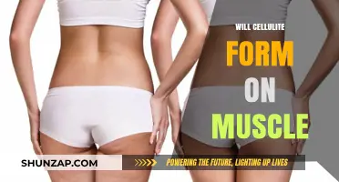 How Muscle Can Affect Cellulite Formation