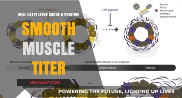 Fatty Liver and Smooth Muscle Antibody Titer: Unraveling the Connection