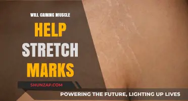 Muscle Gain and Stretch Marks: Can Building Muscle Reduce Their Appearance?