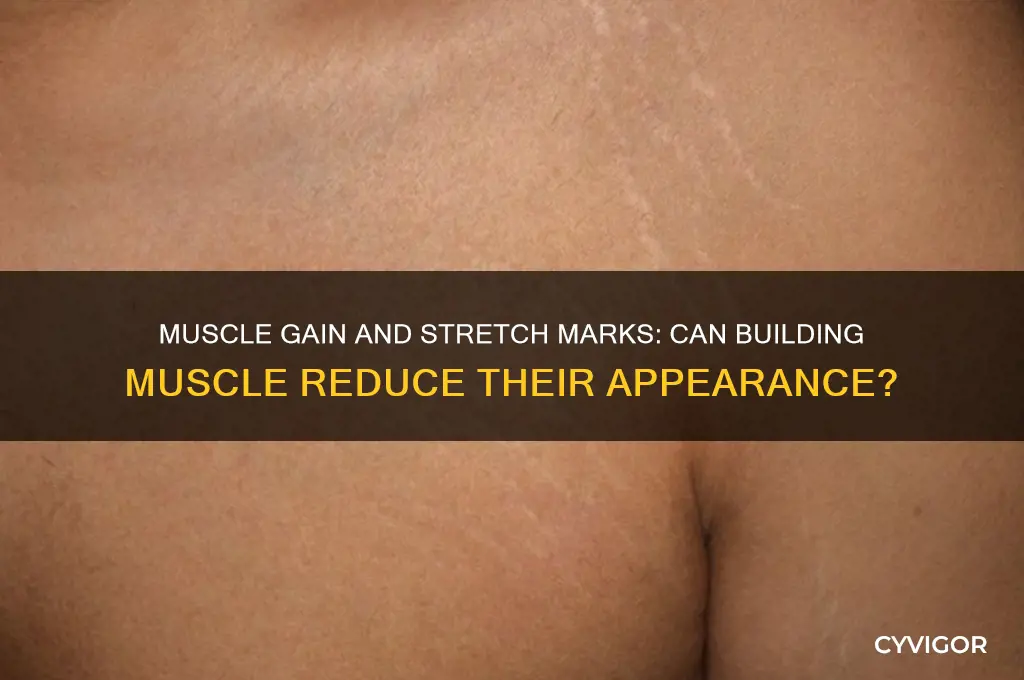 will gaining muscle help stretch marks