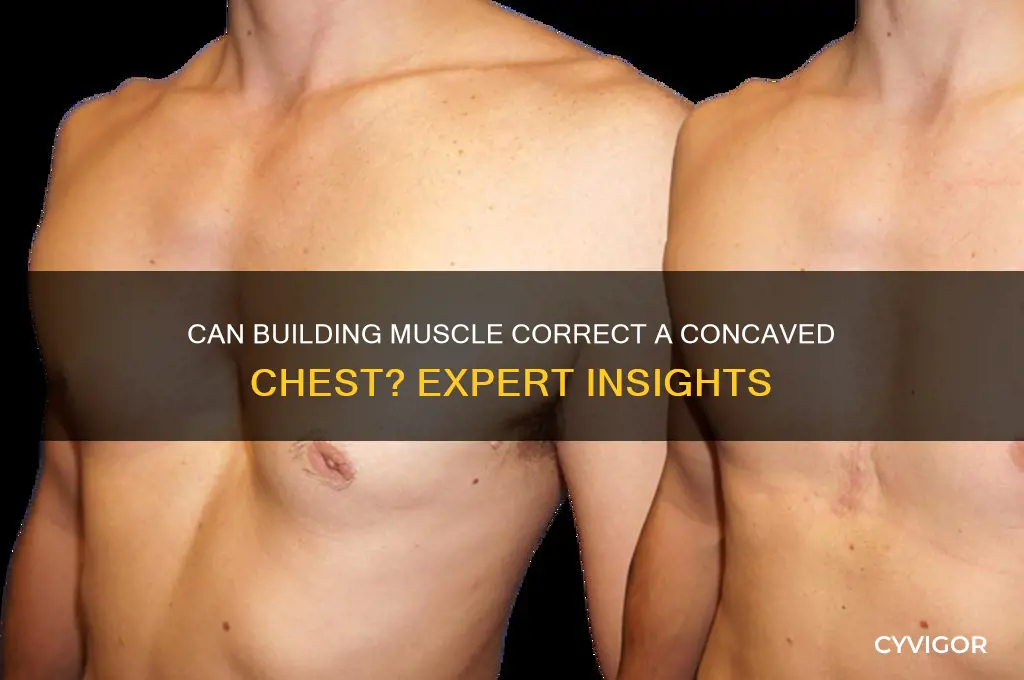 will gaining muscle help with a concaved chest