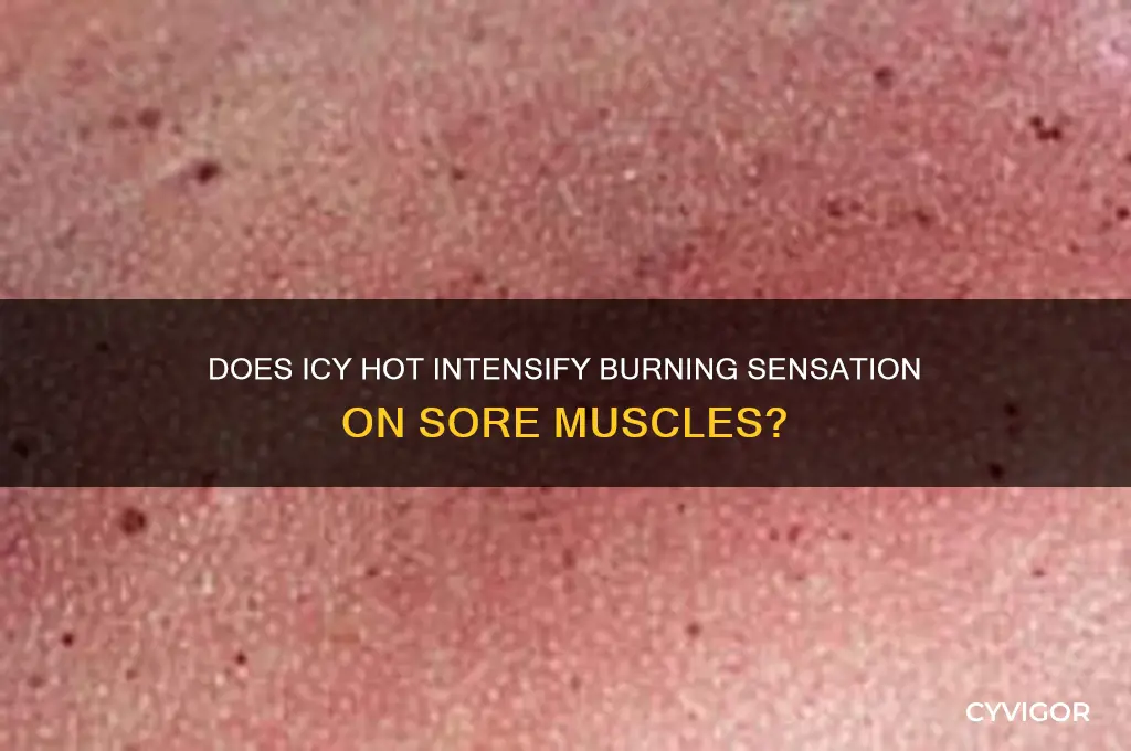 will icy hot burn worse on the sore muscles