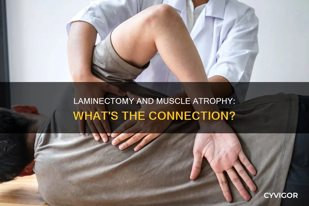 will laminectomy fix muscle atrophy