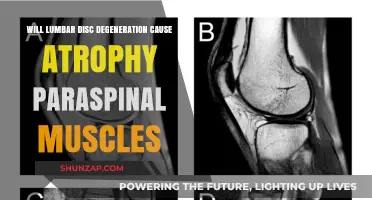 Lumbar Disc Degeneration and Paraspinal Muscle Atrophy: Exploring the Link