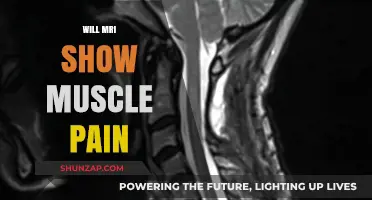 Can MRI Detect Muscle Pain? Understanding Imaging Limits and Alternatives