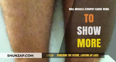 Does Muscle Atrophy Increase Vein Visibility? Understanding the Connection