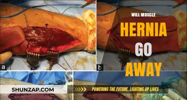 Muscle Hernia: Can It Heal Itself?