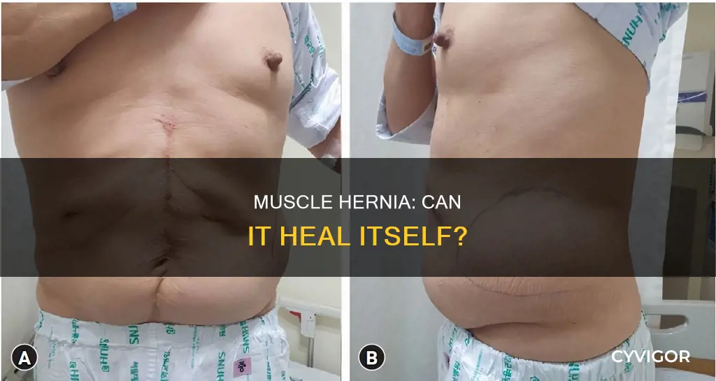 will muscle hernia go away