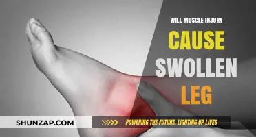 Can Muscle Injuries Lead to Swollen Legs? Understanding the Connection
