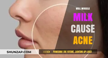 Does Muscle Milk Trigger Acne? Uncovering the Truth Behind the Myth