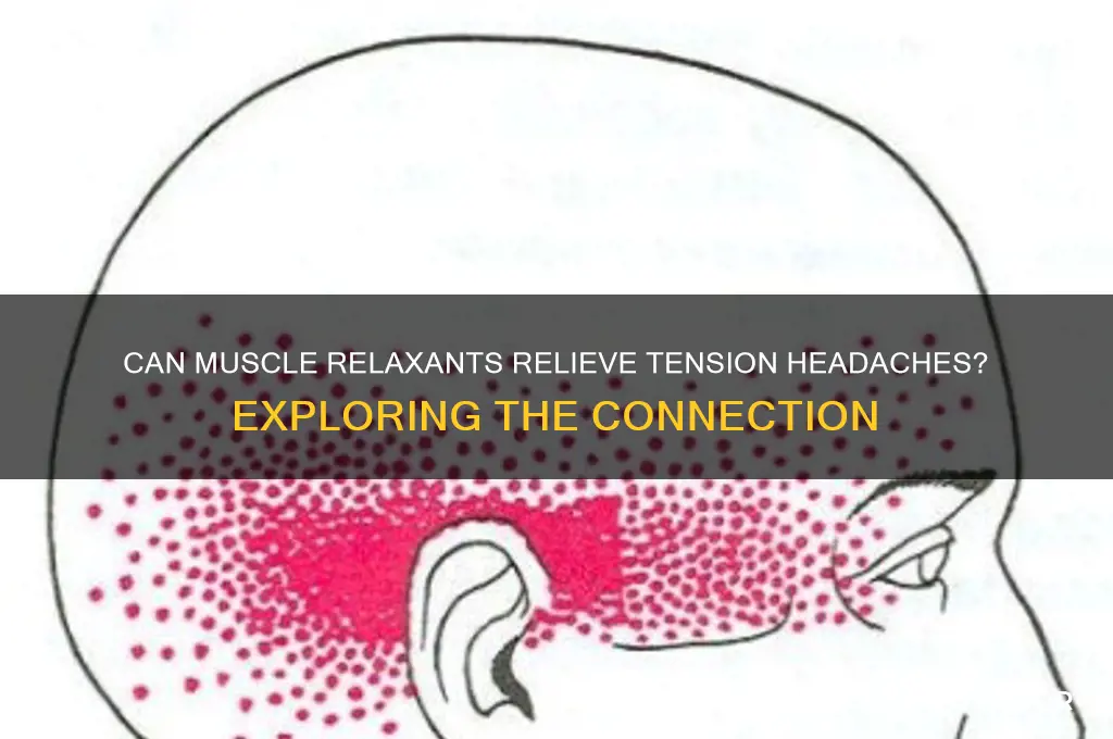 will muscle relaxents fix tension headaches
