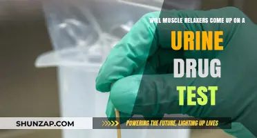 Do Muscle Relaxers Show Up on Urine Drug Tests?