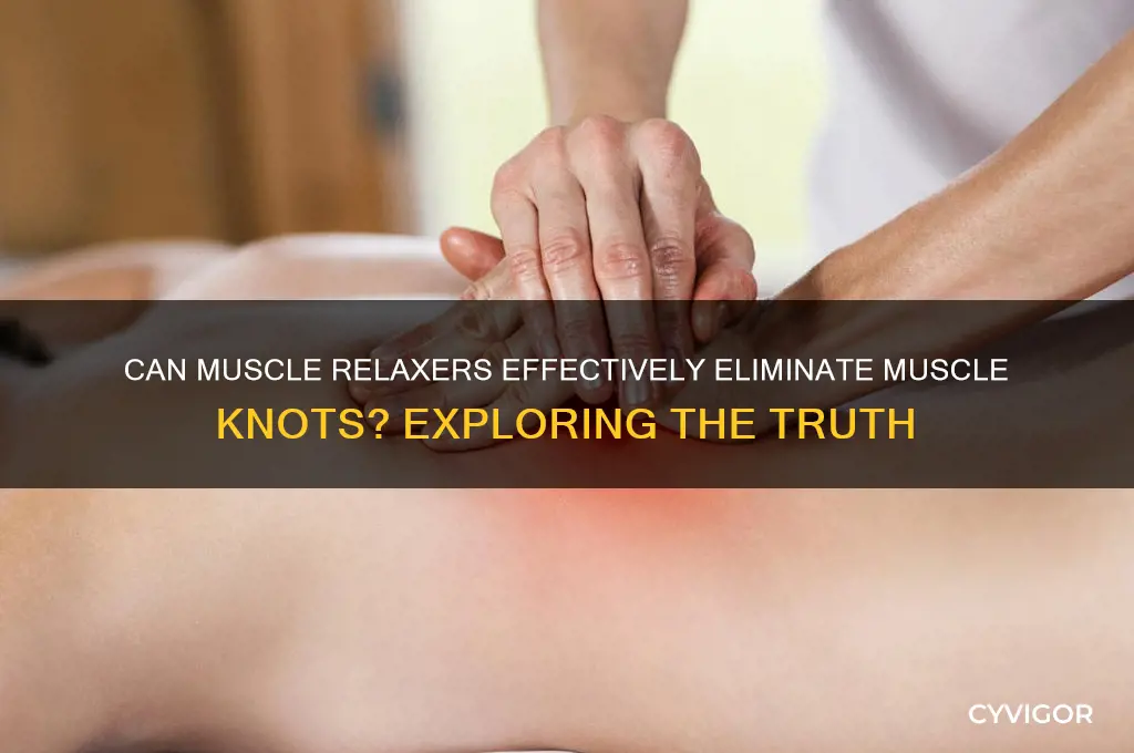 will muscle relaxers get rid of knots