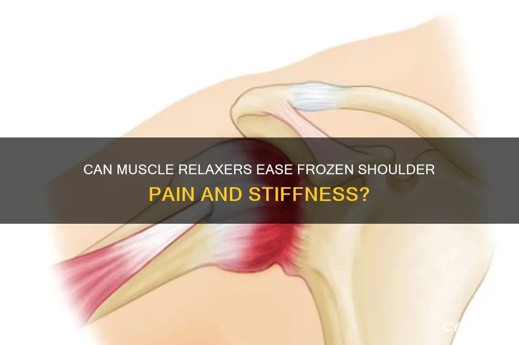 will muscle relaxers relieve frozen shoulder