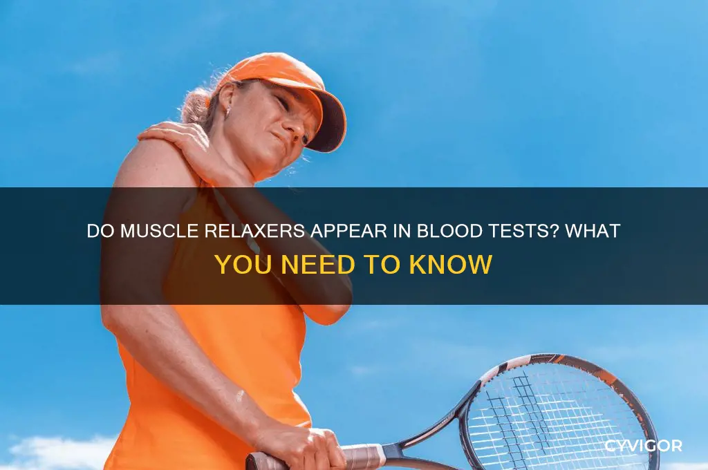 will muscle relaxers show up on a blood test