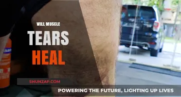 Muscle Tears: Can They Heal?