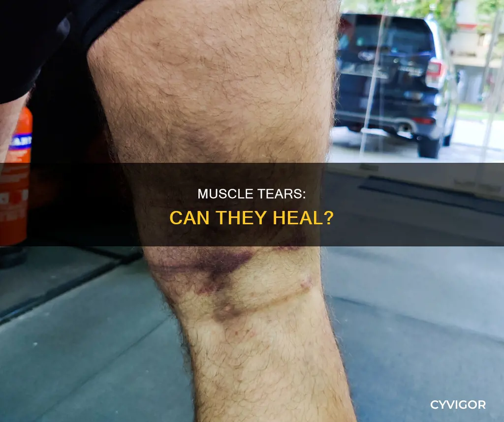 will muscle tears heal