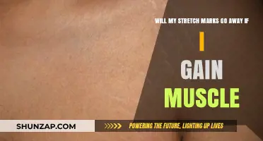Can Building Muscle Reduce Stretch Marks? The Truth Revealed