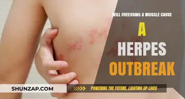 Can Overusing a Muscle Trigger Herpes Outbreaks? Facts Revealed