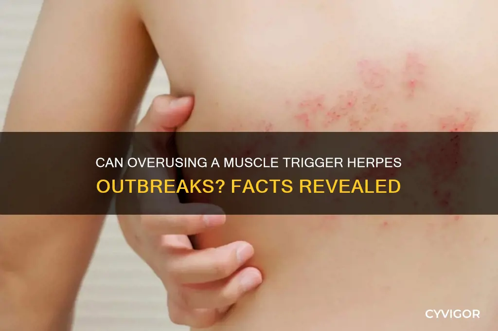 will oveeusing a muscle cause a herpes outbreak