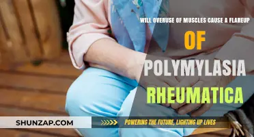 Can Overusing Muscles Trigger Polymyalgia Rheumatica Flare-Ups?