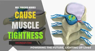 Pinched Nerves and Muscle Tightness: Understanding the Connection and Relief