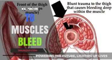 Muscle Punctures: What to Expect and Why