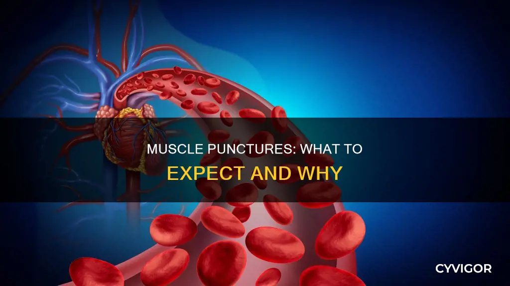 will puncture to muscles bleed
