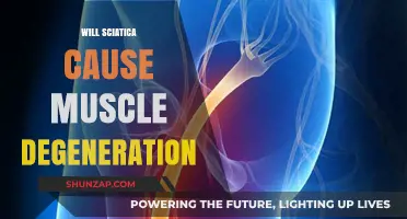 Can Sciatica Lead to Muscle Degeneration? Understanding the Connection