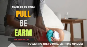 Can Muscle Pull Sites Feel Warm? Understanding Post-Injury Sensations