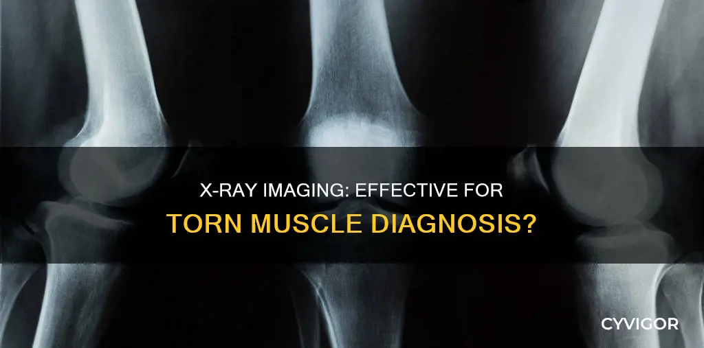 will xray show torn muscle