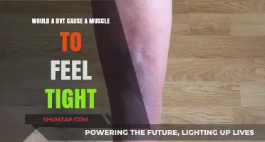Can a DVT Cause Muscle Tightness? Understanding the Connection