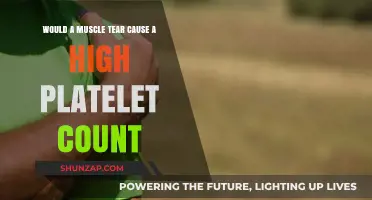 Muscle Tear and Platelet Count: Understanding the Connection