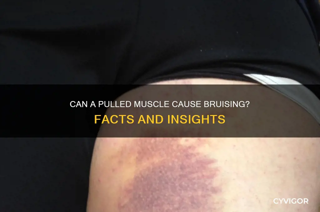would a pulled muscle bruise