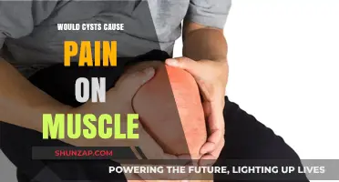 Can Cysts Cause Muscle Pain? Understanding the Connection and Symptoms
