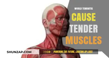Can Tendonitis Lead to Tender Muscles? Understanding the Connection