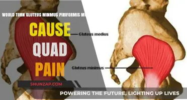 Can Torn Gluteus Minimus or Piriformis Muscles Lead to Quad Pain?
